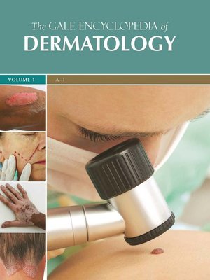 cover image of The Gale Encyclopedia of Dermatology